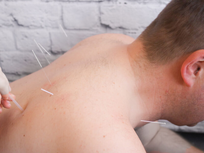 acupuncture services in cumbria
