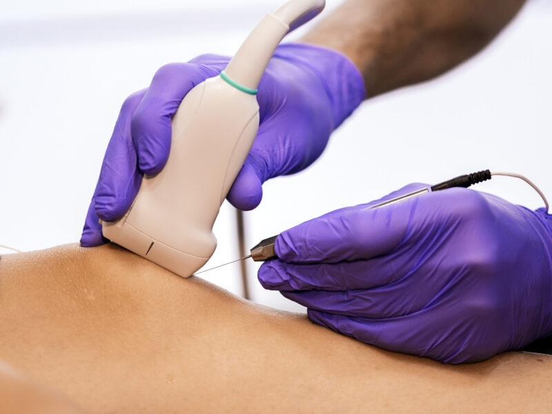 ostenil injection therapy